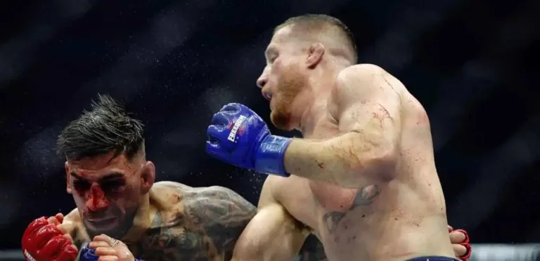 وبالتالي، ستُبعد توبوريا القتال عن عام 2026 بعد الخسارة القاسية في UFC
